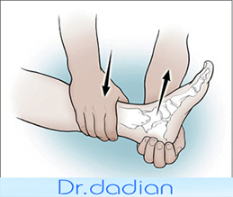 پیچ خوردگی مچ پا(Ankle Sprain)