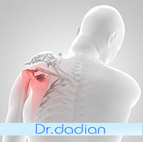 شانه درد و مهمترین علل آن