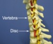 Figure 1 - Relevant Anatomy of a Cervicogenic Headache